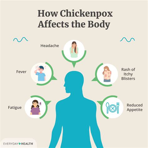 Causes Of Chickenpox Chickenpox