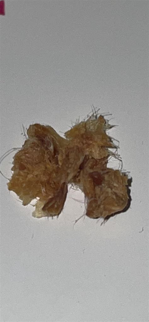 I get these giant earwax flakes every few days, they are itchy until I ...