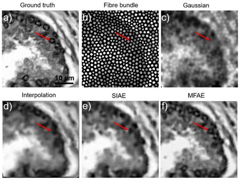 Fiber Bundle Image Reconstruction Using Convolutional Neural Networks ...