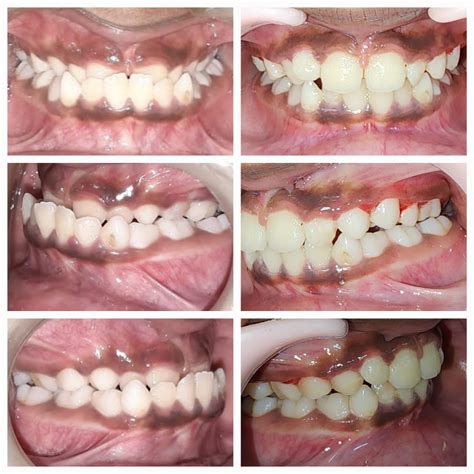 Gallery - PROFILE ORTHODONTICS & COSMETIC DENTISTRY