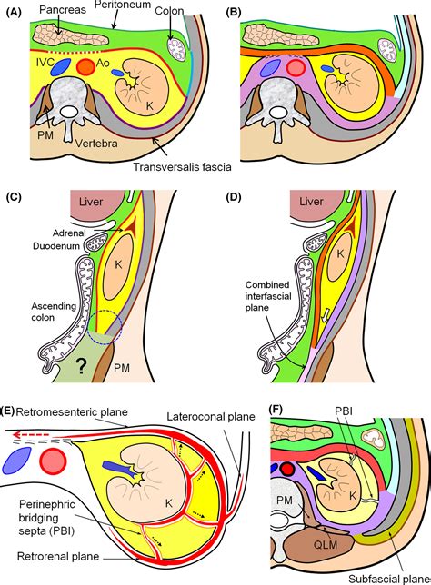 The retroperitoneal interfascial planes: current overview and future perspectives - Ishikawa ...