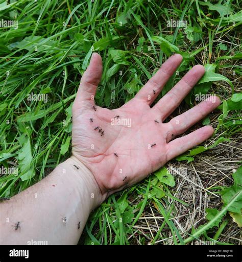 hand of person with black ants above that bite and sting and cause tingling and discomfort to ...