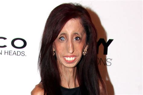 Bullies online called Lizzie Velasquez the world's ugliest woman ...
