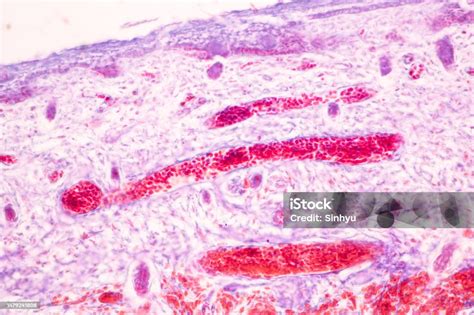 Image result for Finger Under Microscope