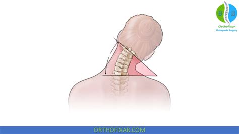 Image result for Cervical Rotators