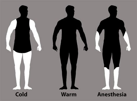 Image result for UnityPoint Health Heat Explained