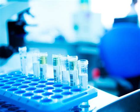 Healthcare lab online in Dharmapuri | Healthcare lab in Dharmapuri ...