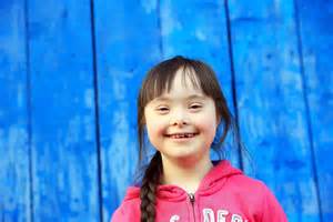 Everything you should know about Down syndrome