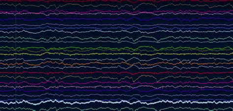 Elon Musk Thinks Neuralink Could Merge Humans With AI; Neuroscience ...