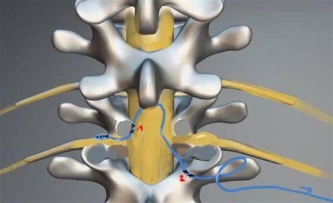 Image result for DRG Rotation Guide