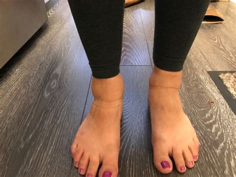 Swollen feet and ankles | BabyCenter