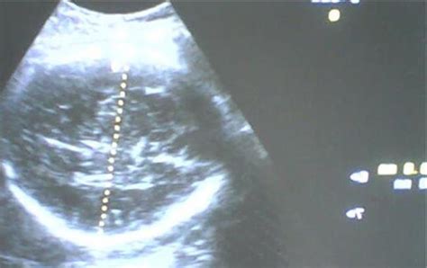 宝妈怀孕14周后流产，网上分享胎儿照片，仅10厘米但手脚都已成型_孩子