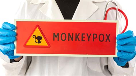 Monkeypox Guideline: मंकीपॉक्स के बढ़ते खतरे को लेकर सरकार ने जारी की ...