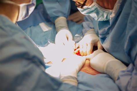 CS Birth 的图像结果