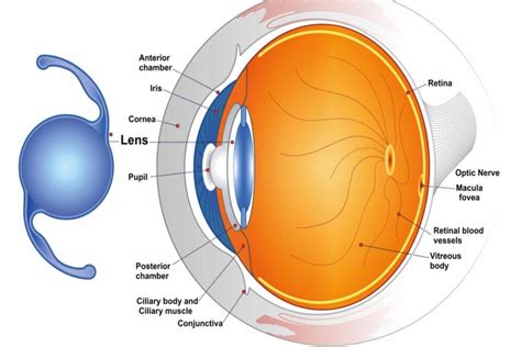 Multifocal Intraocular Lens (IOL) Treatment in Kalyan