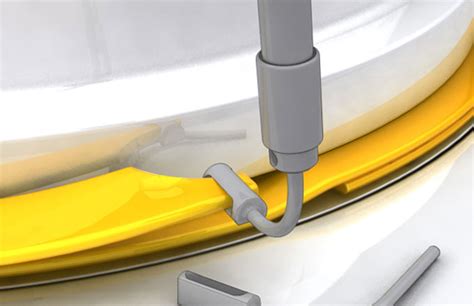 Image result for Ring Removal String Technique