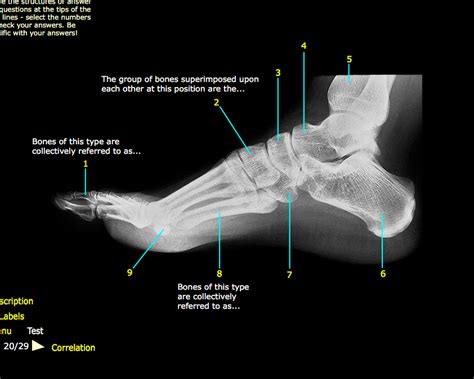 Image result for Toe Lateral View