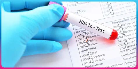 HbA1c Test Guide: Normal Range, A1c Levels, and Significance - Fitterfly