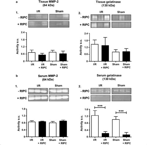 Image result for MMP Pool