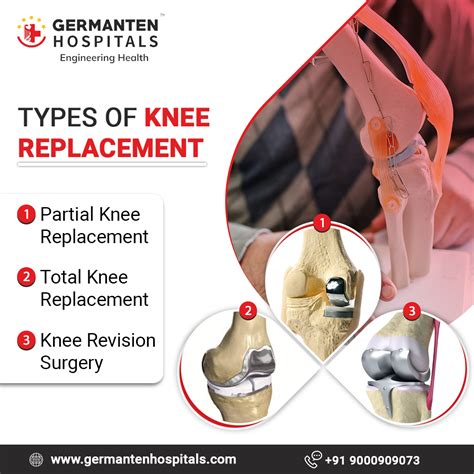Pin on Best Knee Replacement Surgery in Hyderabad