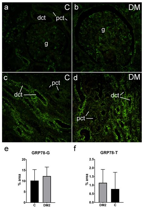 Expression of Autophagy Markers LC3B, LAMP2A, and GRP78 in the Human ...