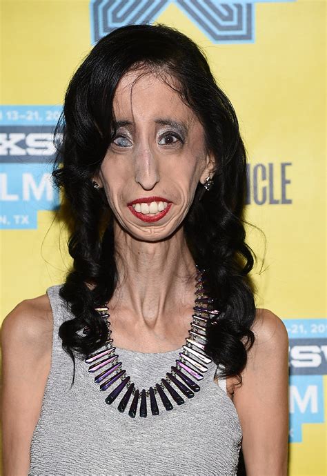 Ugliest Person Alive How 'world's Ugliest Woman' Lizzie Velasquez