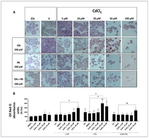 Melatonin as a Repairing Agent in Cadmium- and Free Fatty Acid-Induced ...