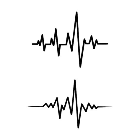 Electrocardiogram ecg waveforms a representation of cardiac activity ...