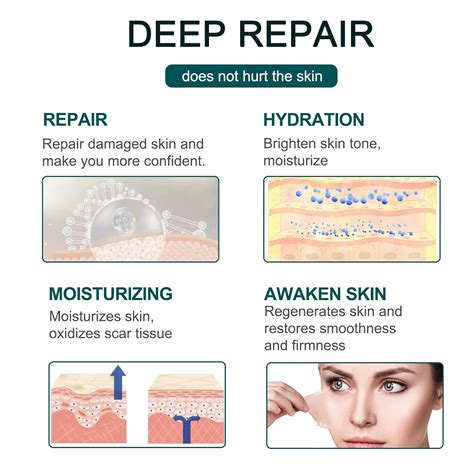 Buy Silicone Scar Sheets, 1.6x120inches, Scar Away Silicone Tape, Scar ...