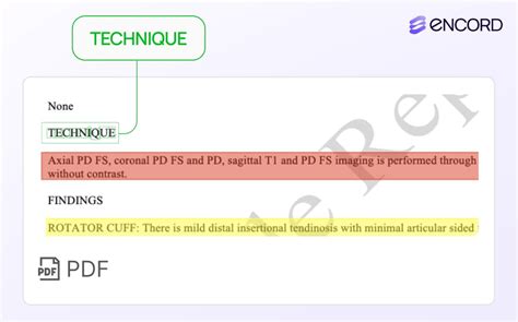 Image result for Power Query Read PDF with OCR