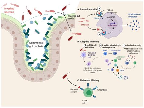 Understanding the Pathogenesis of Spondyloarthritis