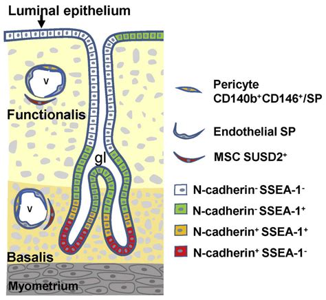 A Revised Stem Cell Theory for the Pathogenesis of Endometriosis