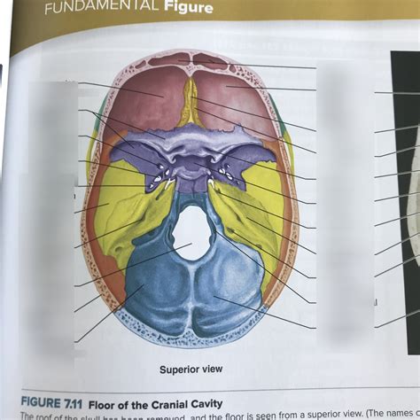 Skull - Superior View Diagram | Quizlet