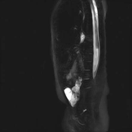 Image result for Myogram Fully Labeled