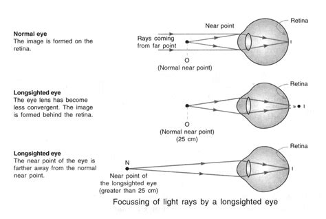 Detailed chapter Notes - Ray Optics : Human Eye and Colourful World ...