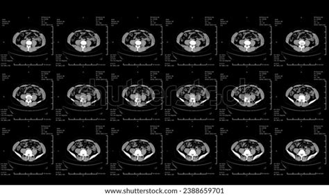 Image result for CT Scanning Machine Animation
