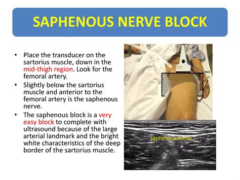 Usg r nerve block | PPTX