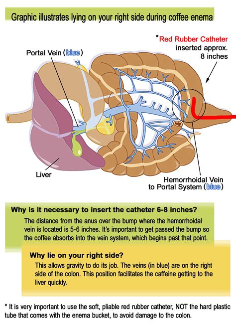 Pin on GERSON {coffee enemas}