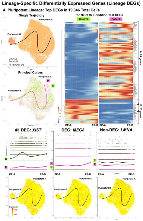 LMNA-Related Dilated Cardiomyopathy: Single-Cell Transcriptomics during Patient-Derived iPSC ...