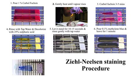 Ziehl neelsen staining | PPTX