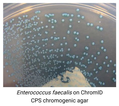 Image result for Enterococcus Faecalis Hemolytic Activity