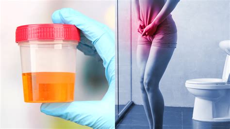 Red Flags in the Bathroom: What Blood in Your Urine Could Be Warning ...