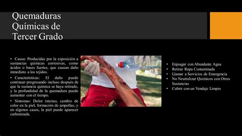 Quemaduras de tercer grado para curso de prehospitalaria | PDF | First Aid | Injuries