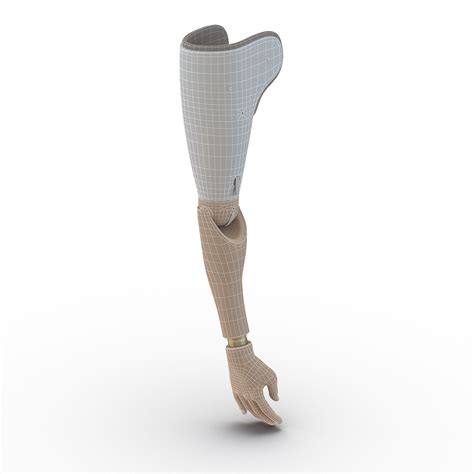 Prosthetic Arm 3D model | 3D Molier International
