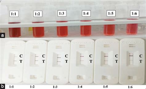 Development of a colloidal Gold nanoparticle-based lateral-flow assay ...