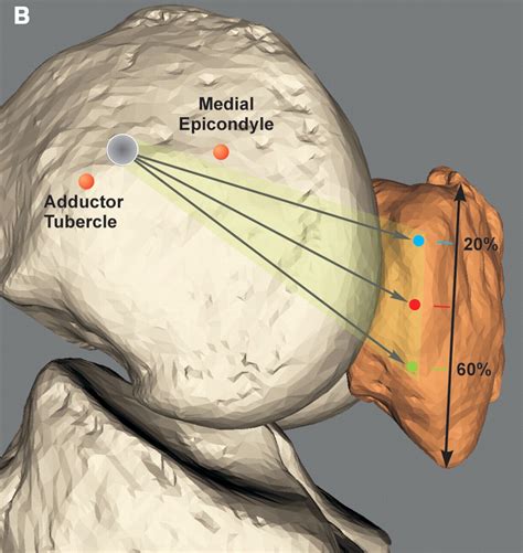 How Isometric Are the Medial Patellofemoral, Superficial Medial ...