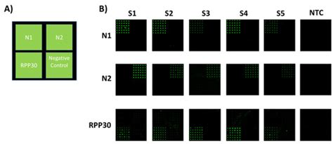 CovidArray: A Microarray-Based Assay with High Sensitivity for the ...