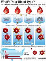 What Is Blood Type A+ at Madeleine Frayne blog