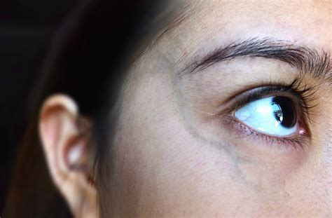 Family Eye Doctor | Dr. Bishop & Associates | Calgary