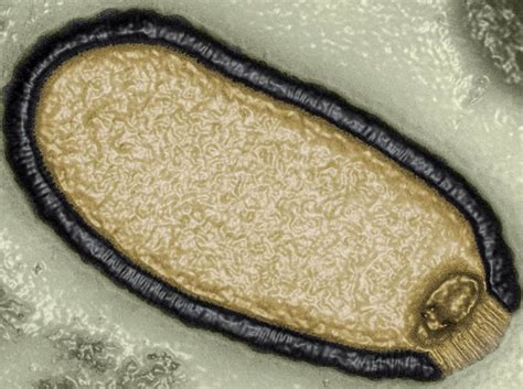 I virus zombie sepolti nel permafrost possono scatenare una nuova epidemia: l'allarme degli ...